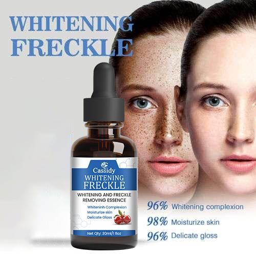 CASSIDY Whitening Frenkle  Removal Serum, 30ml (Pack Of 2)